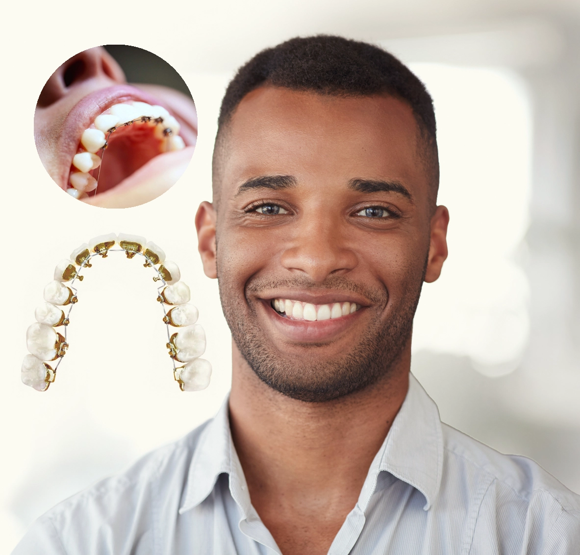 Quick Tips For Relieving Initial Soreness After Getting Braces